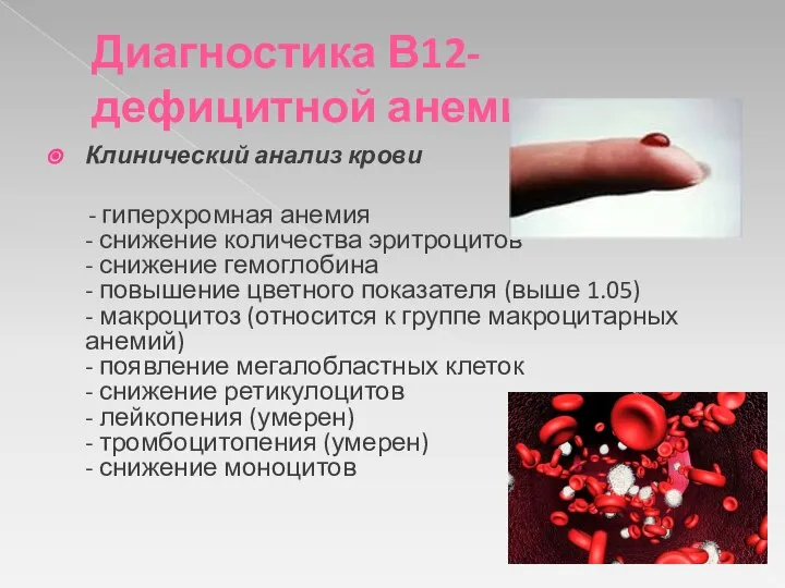 Диагностика В12-дефицитной анемии: Клинический анализ крови - гиперхромная анемия - снижение