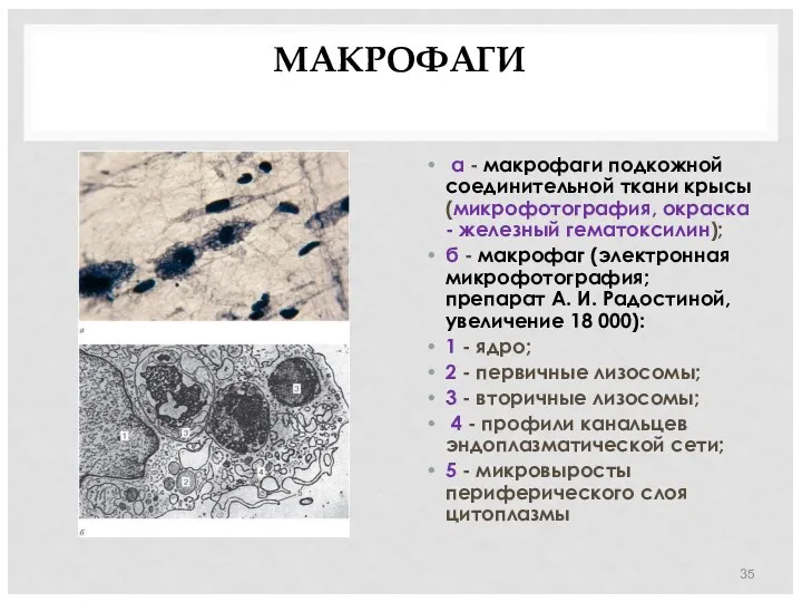 МАКРОФАГИ а - макрофаги подкожной соединительной ткани крысы (микрофотография, окраска -