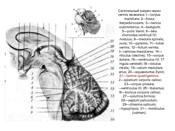 Сагитальный разрез через vermis мозжечка: I—corpus mamillare; 2—fossa interpeduncularis; 3—nervus oculomotorius;