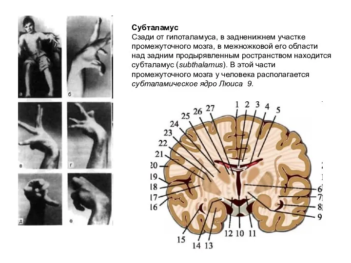 Субталамус Сзади от гипоталамуса, в задненижнем участке промежуточного мозга, в межножковой