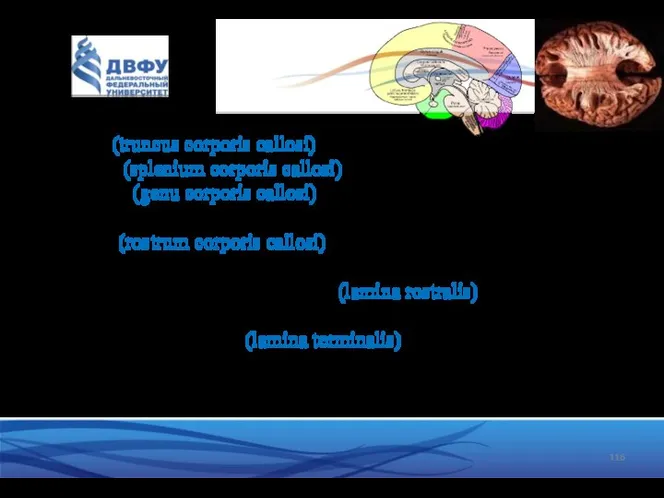 Структура мозолистого тела: - тело (truncus corporis callosi) - удлиненная средняя