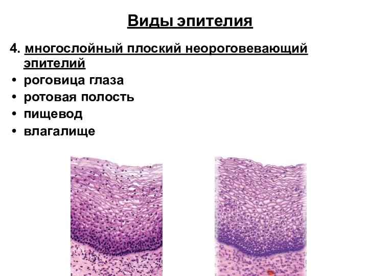 Виды эпителия 4. многослойный плоский неороговевающий эпителий роговица глаза ротовая полость пищевод влагалище