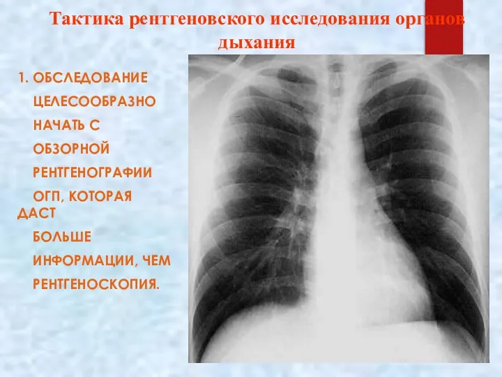 Тактика рентгеновского исследования органов дыхания 1. ОБСЛЕДОВАНИЕ ЦЕЛЕСООБРАЗНО НАЧАТЬ С ОБЗОРНОЙ