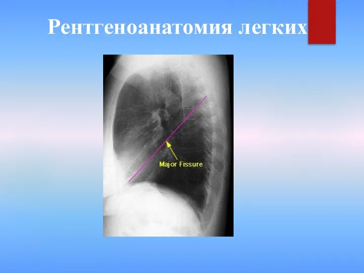 Рентгеноанатомия легких