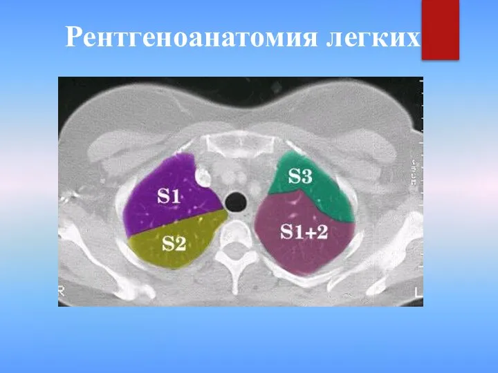 Рентгеноанатомия легких