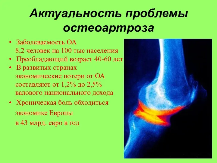 Актуальность проблемы остеоартроза Заболеваемость ОА 8,2 человек на 100 тыс населения