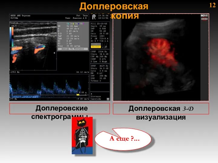 12 Доплеровские спектрограммы Доплеровская эхоскопия Доплеровская 3-D визуализация