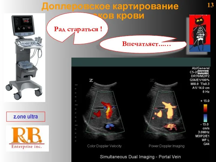 13 Доплеровское картирование потоков крови