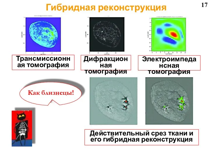 17 Трансмиссионная томография Дифракционная томография Электроимпедансная томография Действительный срез ткани и его гибридная реконструкция Гибридная реконструкция