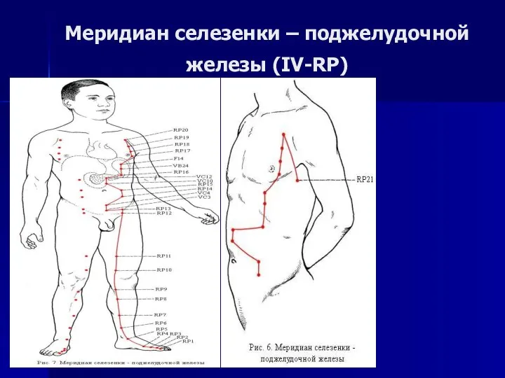 Меридиан селезенки – поджелудочной железы (IV-RP)