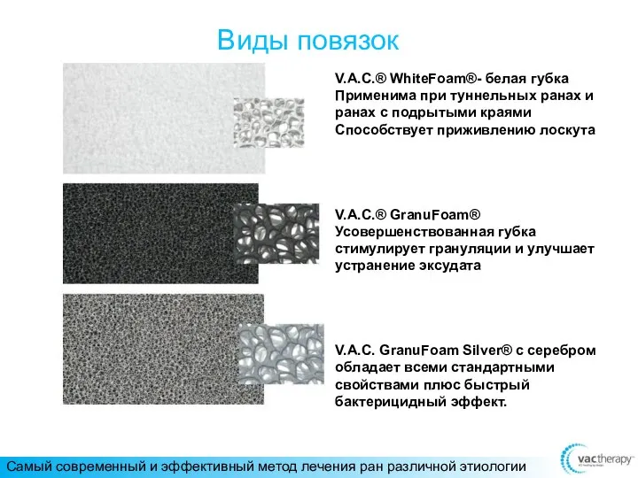 Виды повязок V.A.C.® WhiteFoam®- белая губка Применима при туннельных ранах и