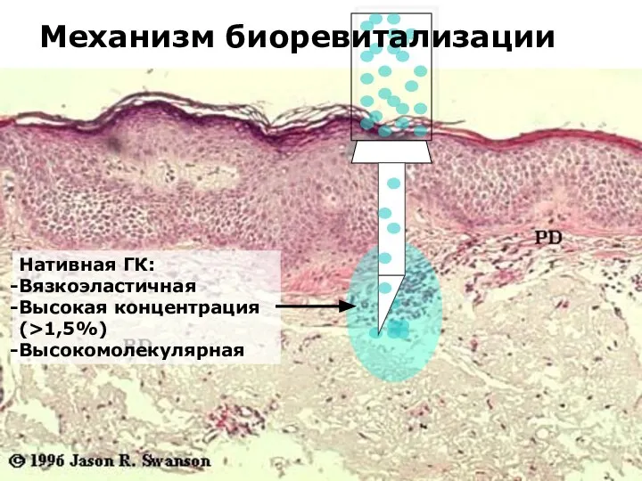 Механизм биоревитализации Нативная ГК: Вязкоэластичная Высокая концентрация (>1,5%) Высокомолекулярная