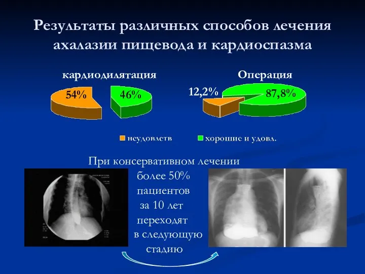 Результаты различных способов лечения ахалазии пищевода и кардиоспазма 46% 54% 87,8%