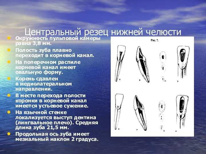 Окружность пульповой камеры равна 3,8 мм. Полость зуба плавно переходит в