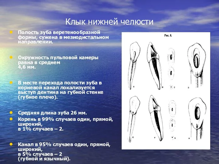 Клык нижней челюсти Полость зуба веретенообразной формы, сужена в мезиодистальном направлении.