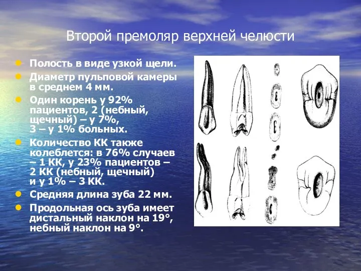 Второй премоляр верхней челюсти Полость в виде узкой щели. Диаметр пульповой