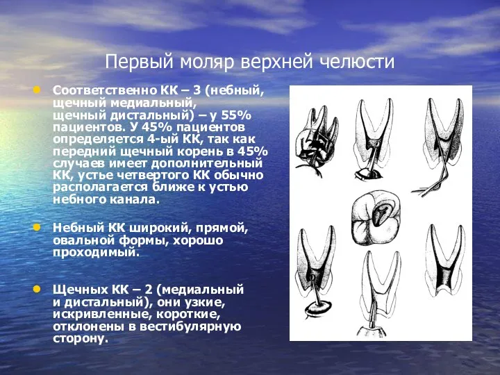 Первый моляр верхней челюсти Соответственно КК – 3 (небный, щечный медиальный,