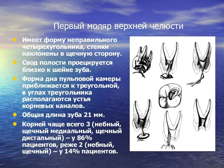 Первый моляр верхней челюсти Имеет форму неправильного четырехугольника, стенки наклонены в