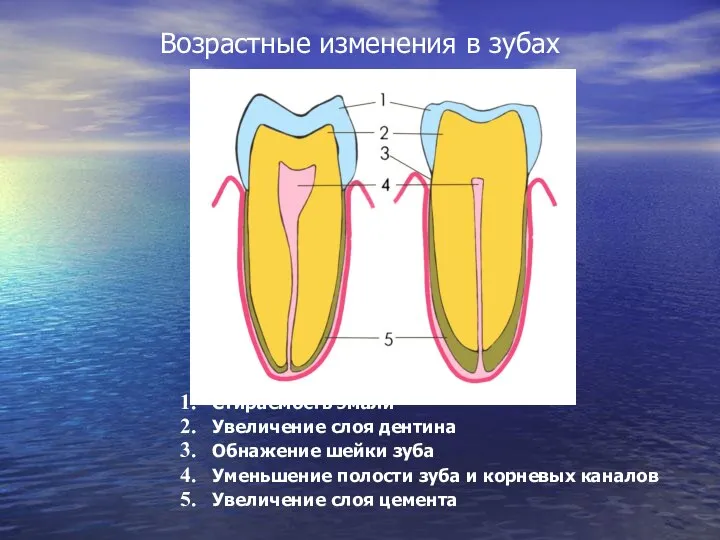 Возрастные изменения в зубах Стираемость эмали Увеличение слоя дентина Обнажение шейки