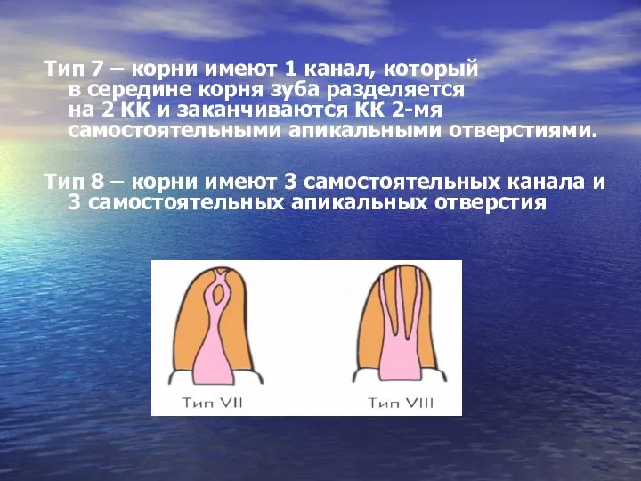 Тип 7 – корни имеют 1 канал, который в середине корня