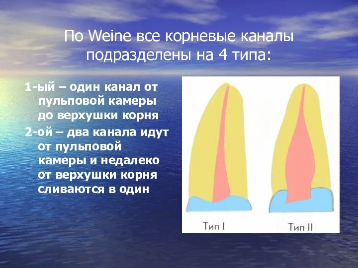 По Weine все корневые каналы подразделены на 4 типа: 1-ый –