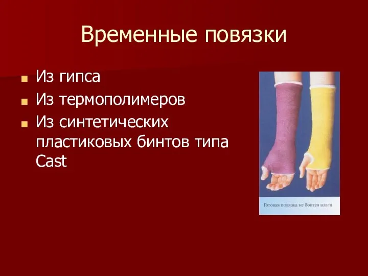 Временные повязки Из гипса Из термополимеров Из синтетических пластиковых бинтов типа Сast