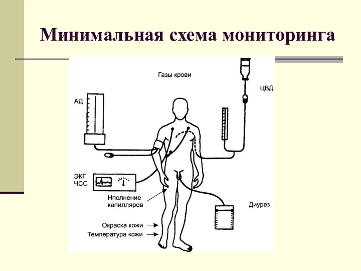 Минимальная схема мониторинга