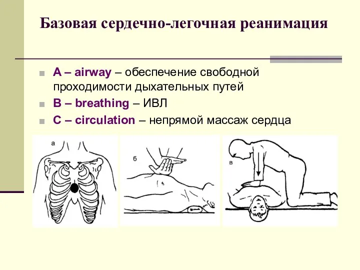 Базовая сердечно-легочная реанимация A – airway – обеспечение свободной проходимости дыхательных