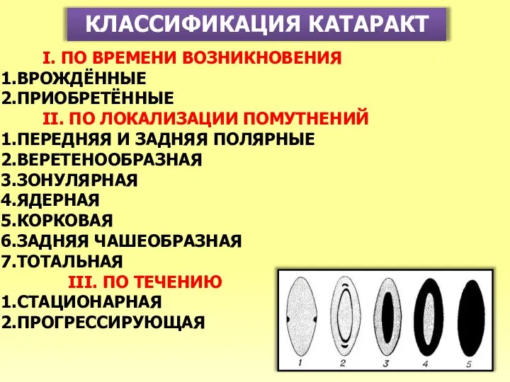 КЛАССИФИКАЦИЯ КАТАРАКТ I. ПО ВРЕМЕНИ ВОЗНИКНОВЕНИЯ ВРОЖДЁННЫЕ ПРИОБРЕТЁННЫЕ II. ПО ЛОКАЛИЗАЦИИ