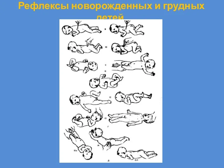 Рефлексы новорожденных и грудных детей.