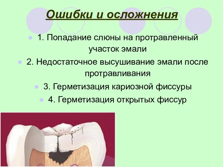 Ошибки и осложнения 1. Попадание слюны на протравленный участок эмали 2.