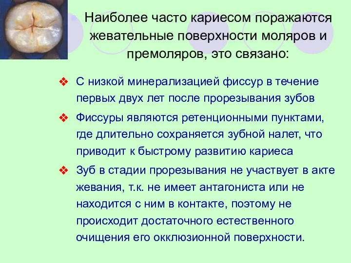 Наиболее часто кариесом поражаются жевательные поверхности моляров и премоляров, это связано: