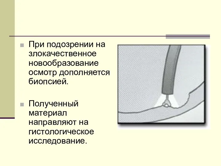 При подозрении на злокачественное новообразование осмотр дополняется биопсией. Полученный материал направляют на гистологическое исследование.