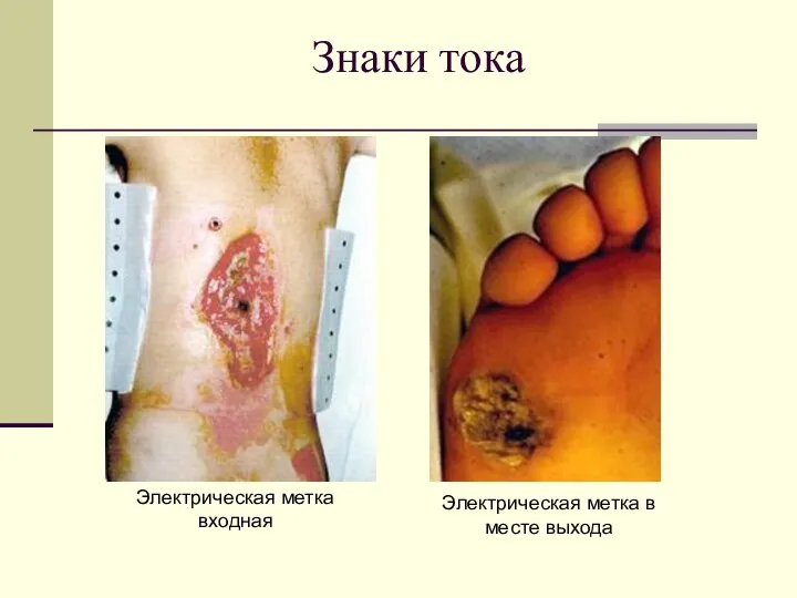 Знаки тока Электрическая метка входная Электрическая метка в месте выхода