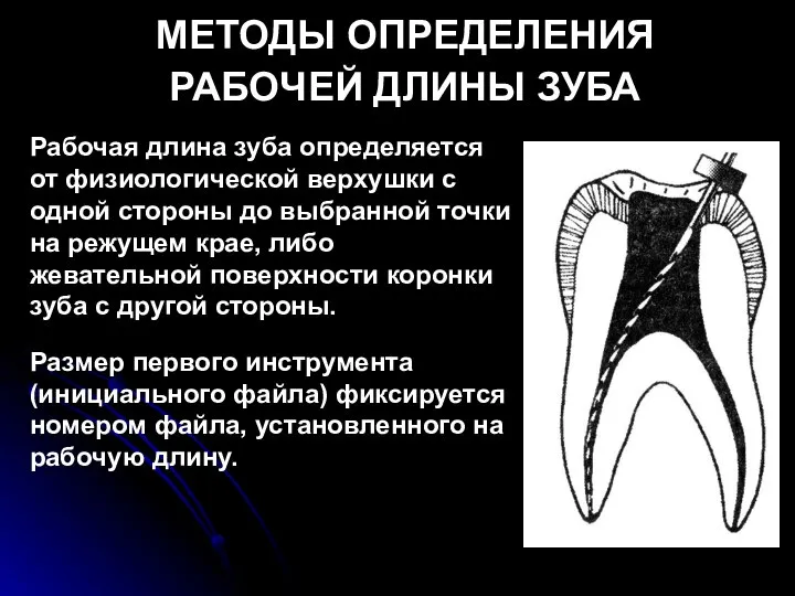 МЕТОДЫ ОПРЕДЕЛЕНИЯ РАБОЧЕЙ ДЛИНЫ ЗУБА Рабочая длина зуба определяется от физиологической