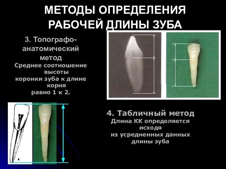 МЕТОДЫ ОПРЕДЕЛЕНИЯ РАБОЧЕЙ ДЛИНЫ ЗУБА 3. Топографо- анатомический метод Среднее соотношение