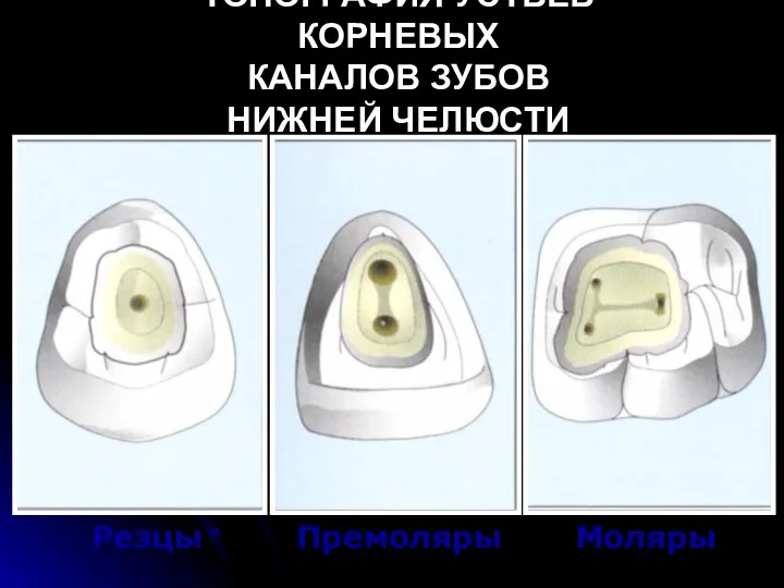 Резцы Премоляры Моляры ТОПОГРАФИЯ УСТЬЕВ КОРНЕВЫХ КАНАЛОВ ЗУБОВ НИЖНЕЙ ЧЕЛЮСТИ