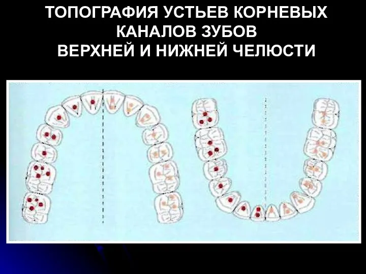 ТОПОГРАФИЯ УСТЬЕВ КОРНЕВЫХ КАНАЛОВ ЗУБОВ ВЕРХНЕЙ И НИЖНЕЙ ЧЕЛЮСТИ