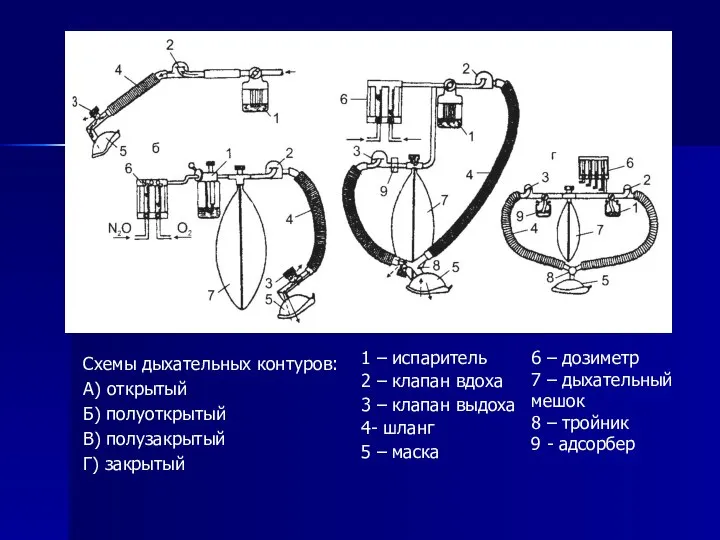 Схемы дыхательных контуров: А) открытый Б) полуоткрытый В) полузакрытый Г) закрытый