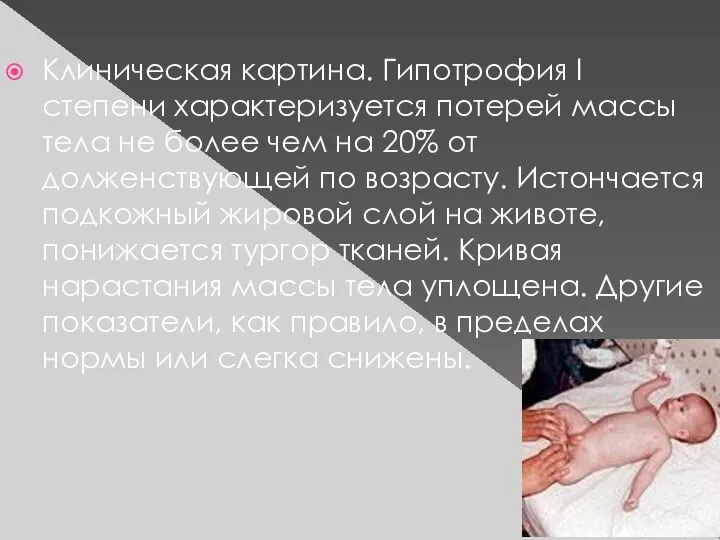 Клиническая картина. Гипотрофия I степени характеризуется потерей массы тела не более