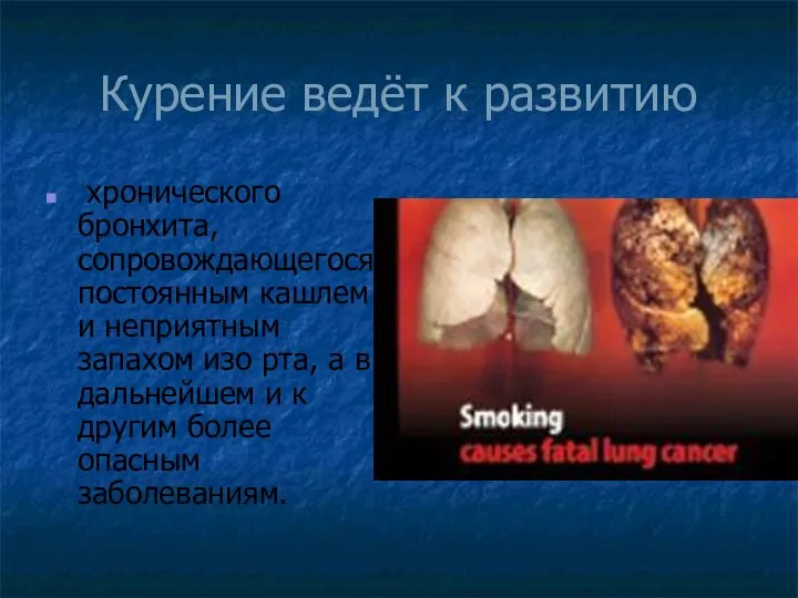 Курение ведёт к развитию хронического бронхита, сопровождающегося постоянным кашлем и неприятным