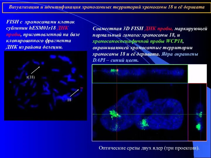 FISH c хромосомами клеток сублинии hESM01r18 ДНК пробы, приготовленной на базе