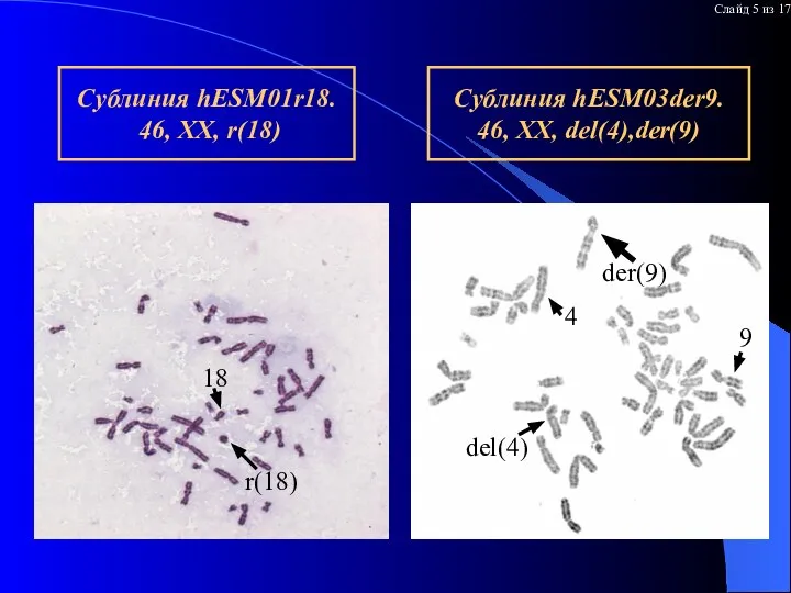 Дифференциальное окрашивание хромосом в аномальных ЭСК Сублиния hESM03der9. 46, XX, del(4),der(9)