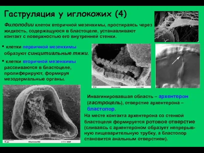 Гаструляция у иглокожих (4) Филоподии клеток вторичной мезенхимы, простираясь через жидкость,