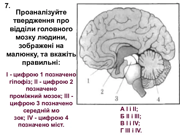 Проаналізуйте твердження про відділи головного мозку людини, зображені на малюнку, та