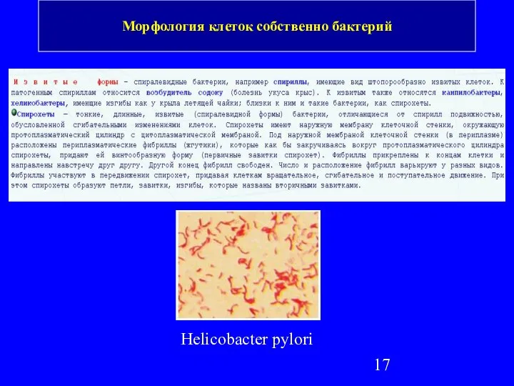 Морфология клеток собственно бактерий Helicobacter pylori