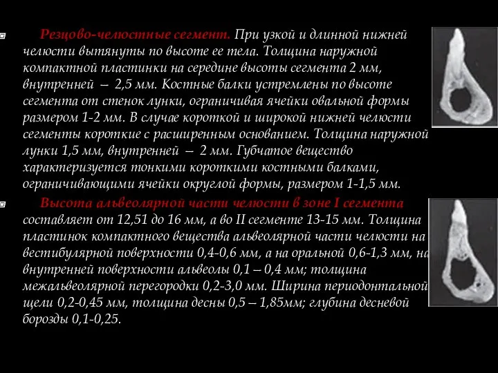 Резцово-челюстные сегмент. При узкой и длинной нижней челюсти вытянуты по высоте