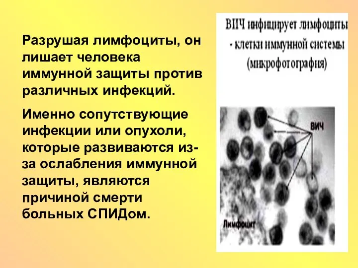 Разрушая лимфоциты, он лишает человека иммунной защиты против различных инфекций. Именно