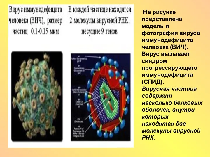 На рисунке представлена модель и фотография вируса иммунодефицита челвоека (ВИЧ). Вирус