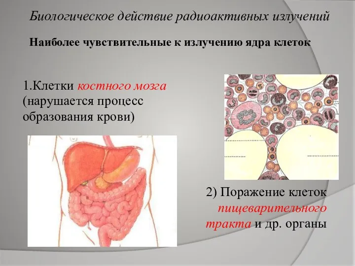 Наиболее чувствительные к излучению ядра клеток 1.Клетки костного мозга (нарушается процесс